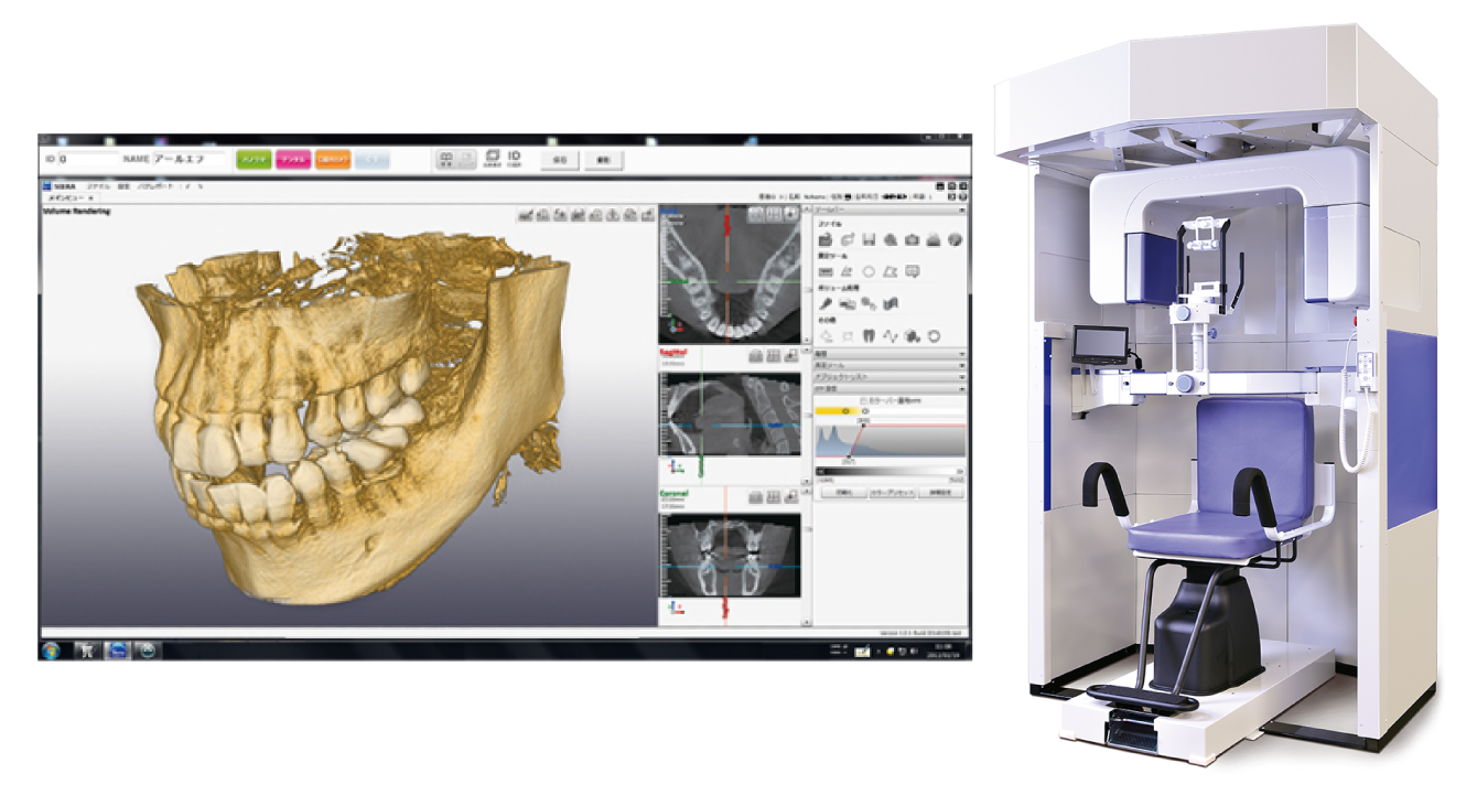 歯科用ＣＴ